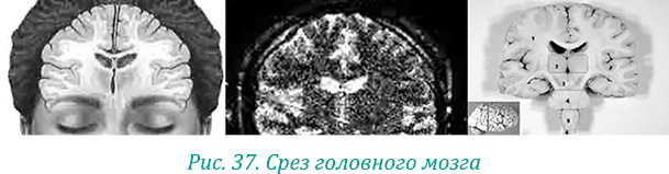 Эволюция – путь во времени: Ментальные и телесные техники сохранения молодости. Квантовая биомеханика тела: Методика оздоровления опорно-двигательного аппарата: Часть 1 - i_048.jpg