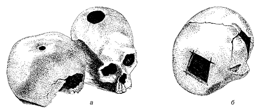 Популярная история медицины - pic_8.png