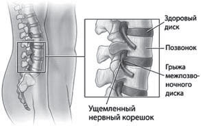 Повернуть время вспять. Система Осьмионика для нижней части лица и шеи - i_016.jpg