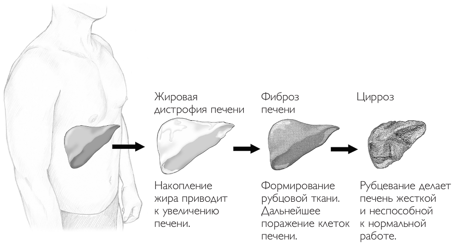 Печень в норме: программа очищения и восстановления печени при явных и скрытых заболеваниях - i_004.png