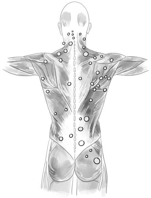 Избавься от триггерных точек. Готовые программы упражнений для устранения боли в позвоночнике, суставах и мышцах - i_004.jpg