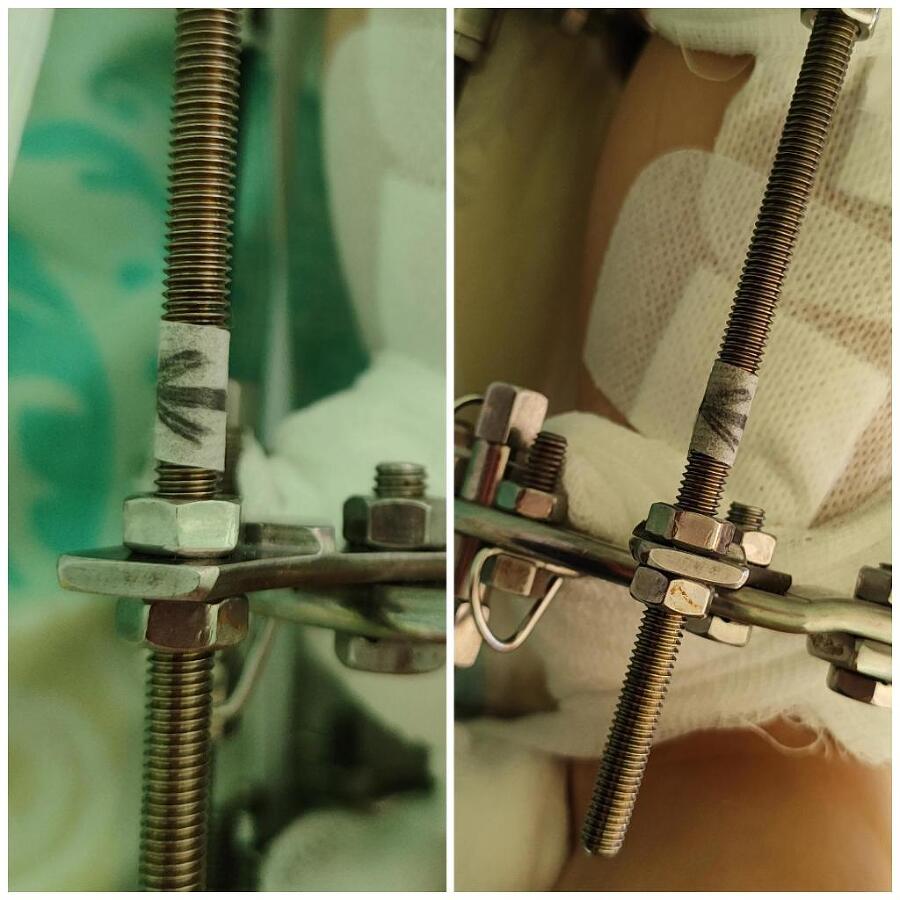 Полгода в больнице с ребёнком: дожить до выписки и не сойти с ума - _11.jpg