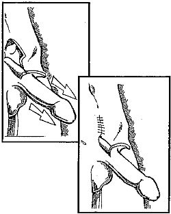 Как увеличить размеры мужского полового члена - i_051.jpg