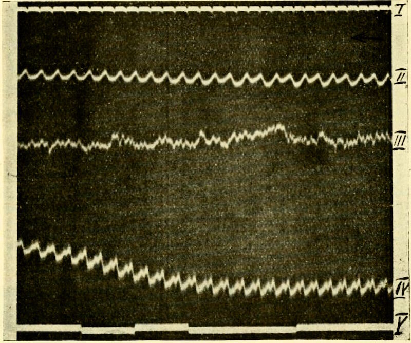 Охота на электроовец. Большая книга искусственного интеллекта - image139.jpg