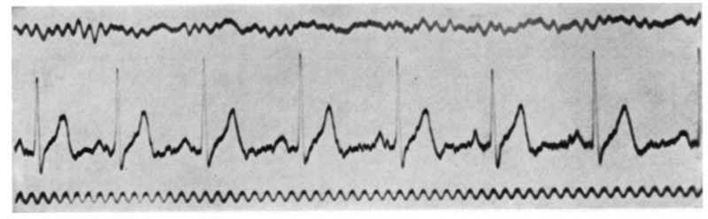 Охота на электроовец. Большая книга искусственного интеллекта - image141.jpg