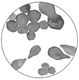 Разрушители. Грибки и грядущая пандемия - i_003.jpg