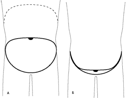 Говори свободно. Создавая совершенный голос - _38.png