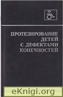 Протезирование детей с дефектами конечностей