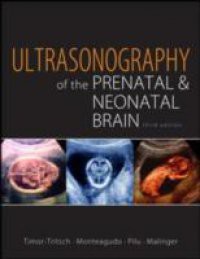 Ultrasonography of the Prenatal Brain, Third Edition