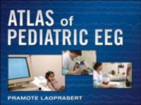 Atlas of Pediatric EEG