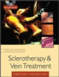 Sclerotherapy and Vein Treatment, Second Edition SET