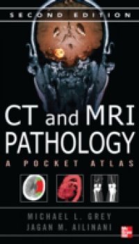 CT & MRI Pathology: A Pocket Atlas, Second Edition