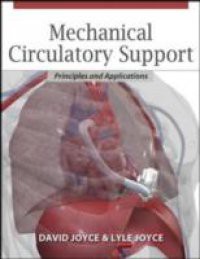 Mechanical Circulatory Support: Principles and Applications