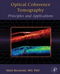 Optical Coherence Tomography