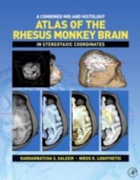 Combined MRI and Histology Atlas of the Rhesus Monkey Brain in Stereotaxic Coordinates