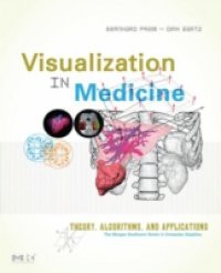 Visualization in Medicine