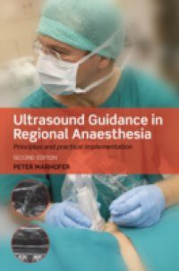 Ultrasound Guidance in Regional Anaesthesia: Principles and practical implementation