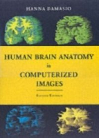 Human Brain Anatomy in Computerized Images