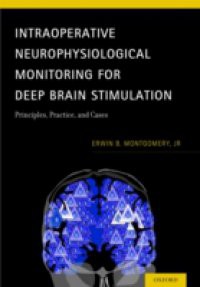 Intraoperative Neurophysiological Monitoring for Deep Brain Stimulation: Principles, Practice and Cases