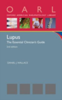 Lupus: The Essential Clinicians Guide