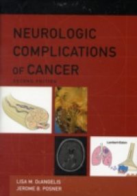 Neurologic Complications of Cancer