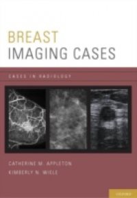 Breast Imaging Cases