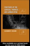 Fractures of the Cervical, Thoracic, and Lumbar Spine