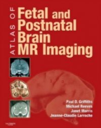 Atlas of Fetal and Infant Brain MR