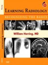 Learning Radiology: Recognizing the Basics