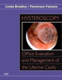 Hysteroscopy: Office Evaluation and Management of the Uterine Cavity