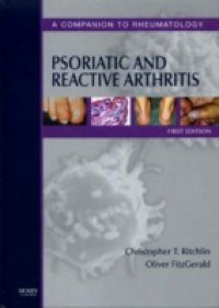 Psoriatic and Reactive Arthritis