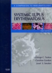 Systemic Lupus Erythematosus