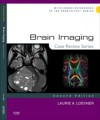Brain Imaging: Case Review Series