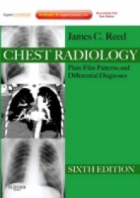 Chest Radiology Plain Film Patterns and Differential Diagnoses