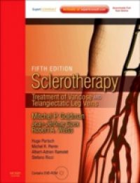 Sclerotherapy