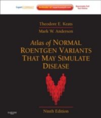 Atlas of Normal Roentgen Variants That May Simulate Disease