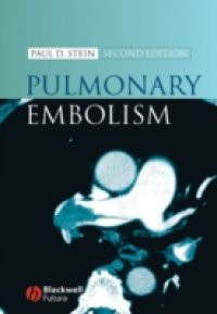 Pulmonary Embolism