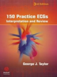 150 Practice ECGs