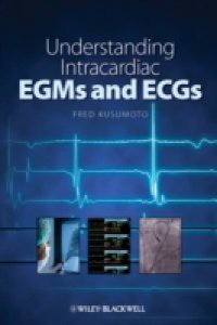 Simplified Interpretation of Pacemaker ECGs