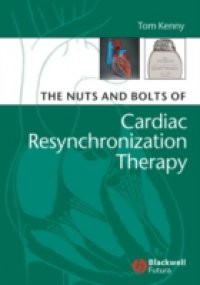 Nuts and Bolts of Cardiac Resynchronization Therapy