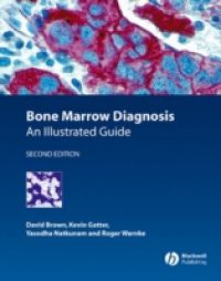 Bone Marrow Diagnosis