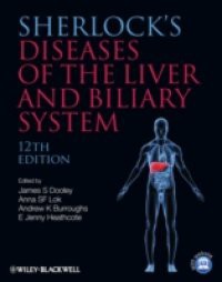 Diseases of the Liver and Biliary System