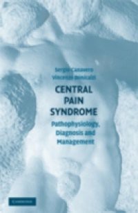 Central Pain Syndrome