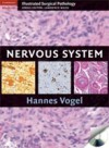 Nervous System