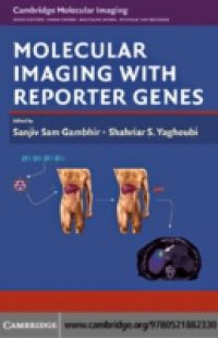 Molecular Imaging with Reporter Genes