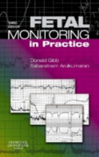 Fetal Monitoring in Practice