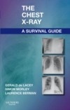 Chest X-Ray: A Survival Guide