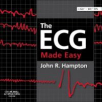 ECG Made Easy