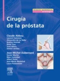 Cirugia de la prostata