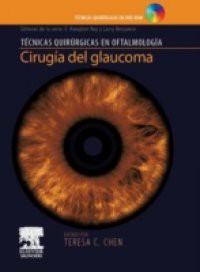 Cirugia del glaucoma